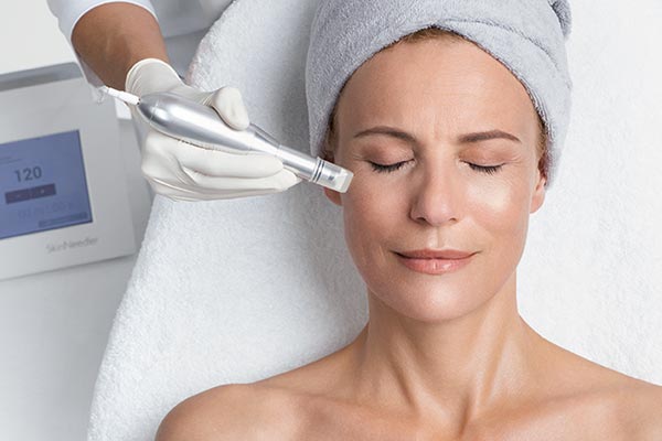 Micro-Needling Micro-Needling